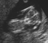 Full picture from scanning in the 12th week. Lots of life and movement in there.